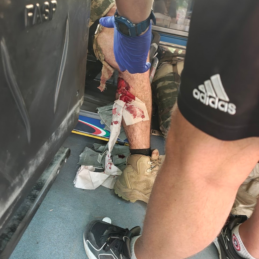 Wounded leg, rotation near Zaporizhzhia